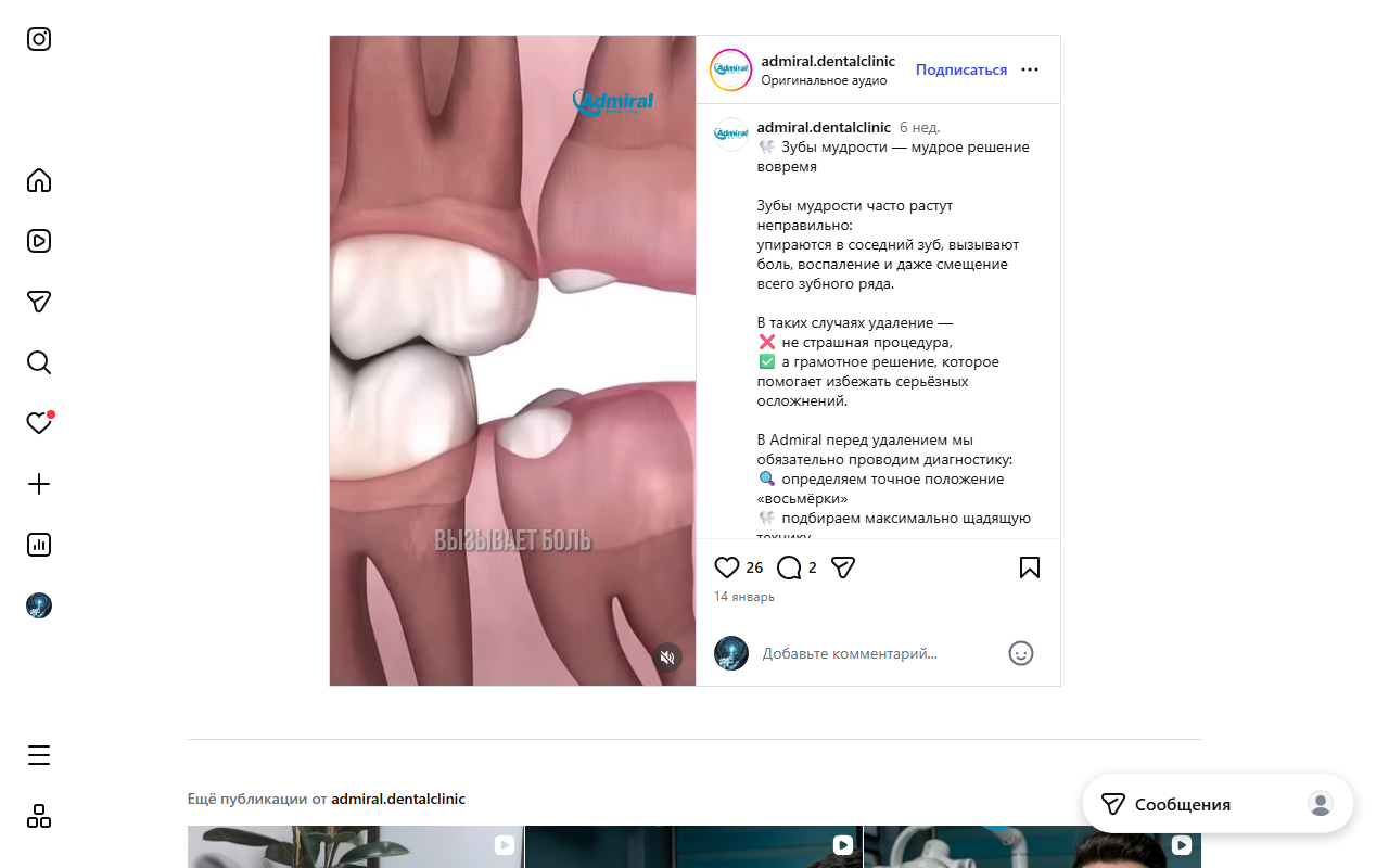 Хирургия зубов