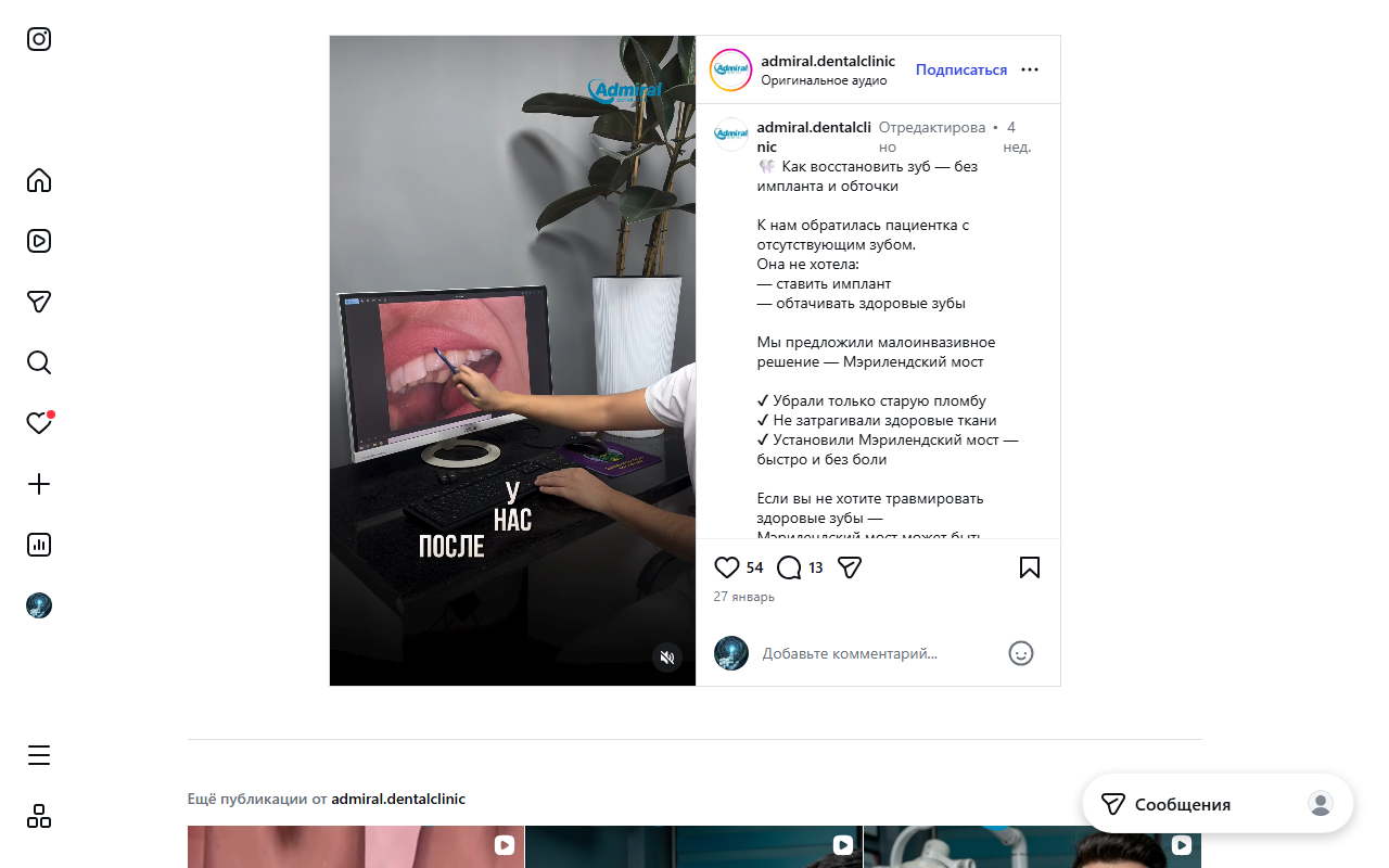 Имплантация зубов